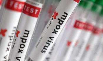 Estados Unidos confirmam primeiro caso de nova variante da mpox