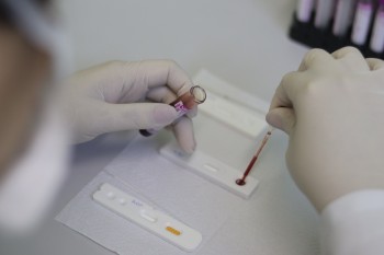 Campanha garante 1,2 mil testes rápidos para HIV, sífilis e hepatite
