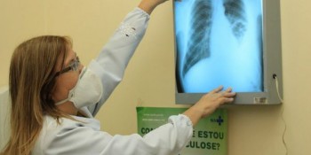 Brasil instala comitê interministerial para eliminação da tuberculose 