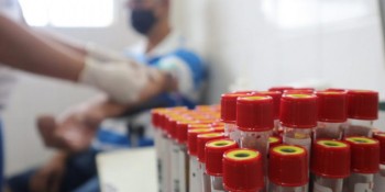 Alto Tietê promove ações para a Campanha Novembro Azul