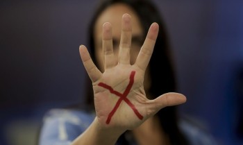 Mulheres vítimas de violência podem ter reconstrução dentária pelo SUS