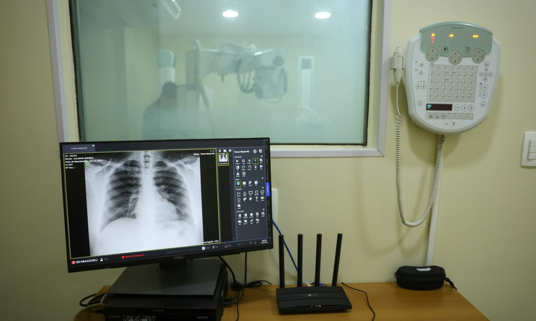 Brasil tem aumento de hospitalizações por Influenza A, alerta Fiocruz