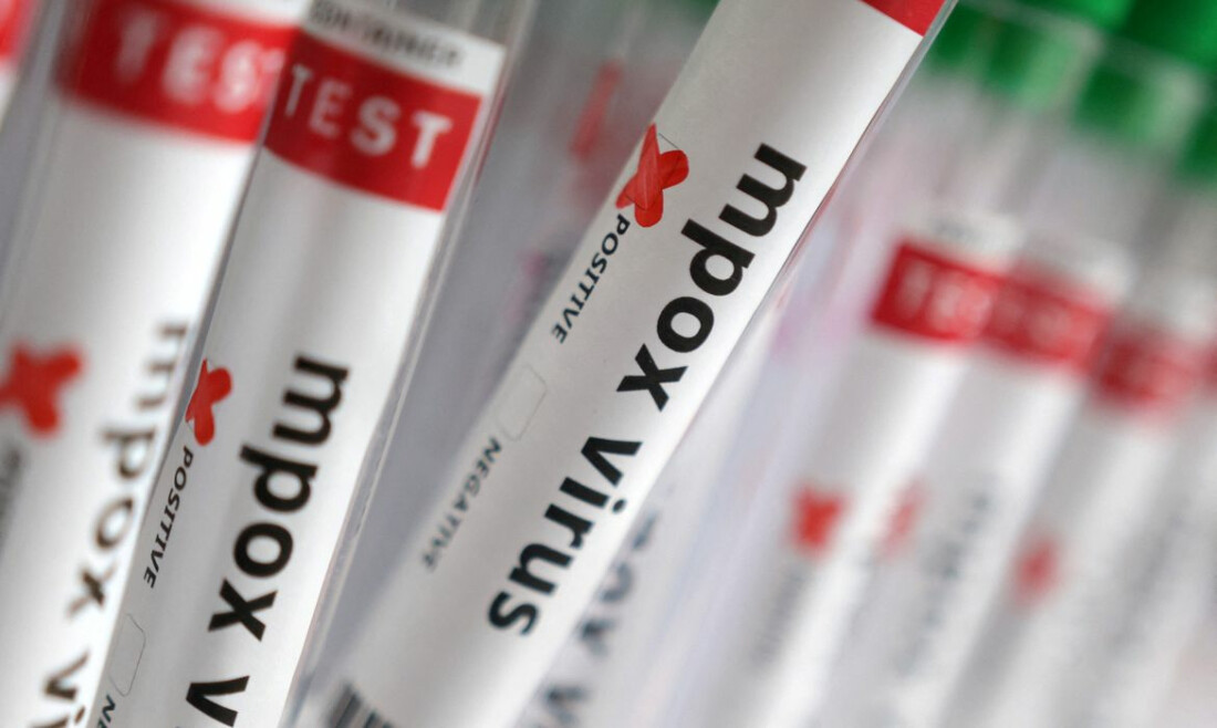 Região Norte do Brasil registra casos de mpox