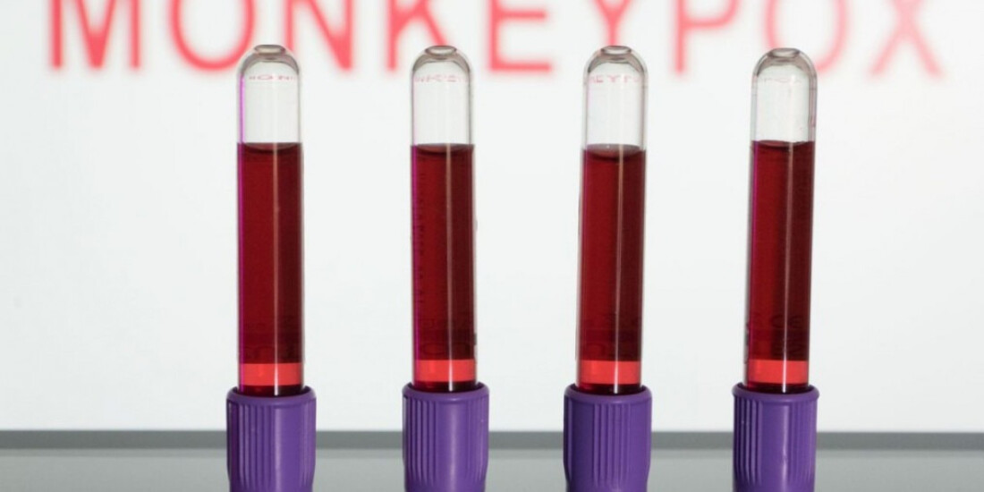 Ministério da Saúde amplia testagem de varíola dos macacos