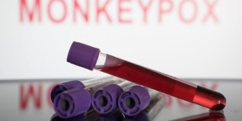 Alto Tietê confirma 65 casos de Monkeypox