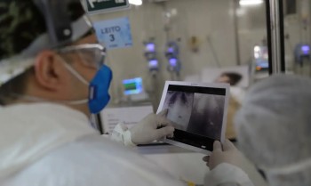Covid é principal causa de internação por síndrome respiratória no Rio