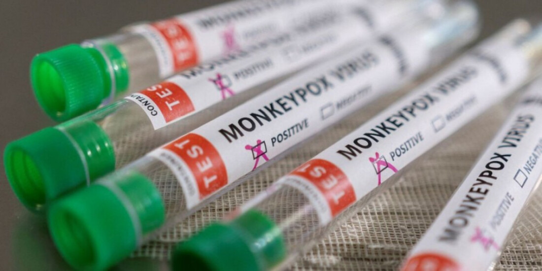 Estado do Rio notifica terceira morte por varíola dos macacos