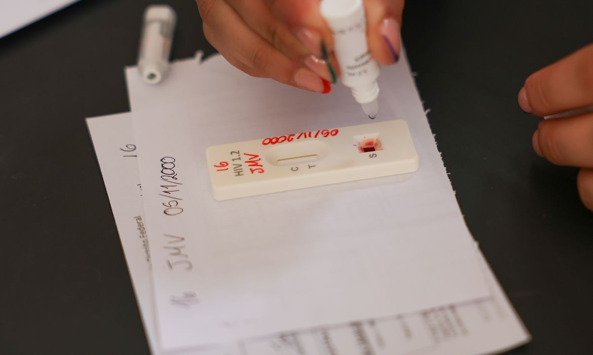 Ação no DF oferece testagem rápida e informação sobre HIV/Aids