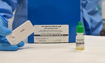 Novo teste faz diagnóstico de hantavirose em 20 minutos