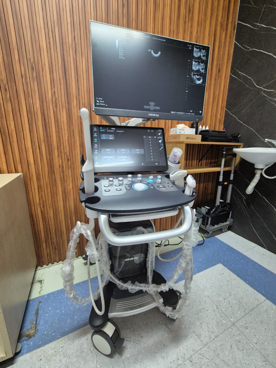 Inteligência artificial no ultrassom otimiza exames na Santa Casa de Mogi