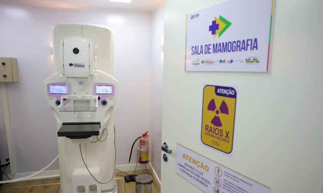 Lei garante mamografia pelo SUS para mulheres a partir dos 40 anos