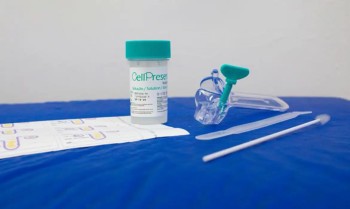 Guia orienta sobre mudança de rastreamento do câncer de colo do útero