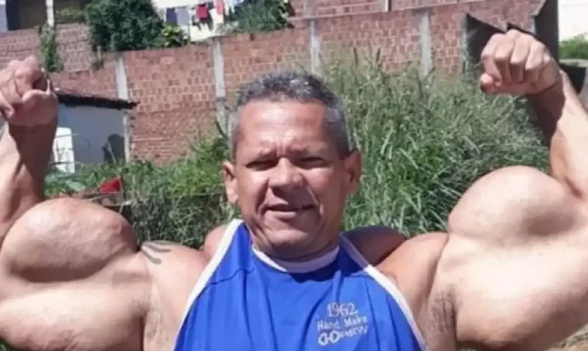 Morre Arlindo de Souza, conhecido como "Popeye Brasileiro"