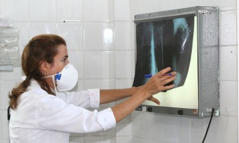 OMS recomenda testes de diagnóstico rápido para erradicar tuberculose