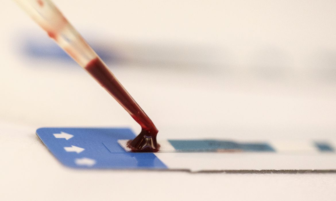 Estudo inédito da Fiocruz pode ampliar prevenção de HIV entre jovens
