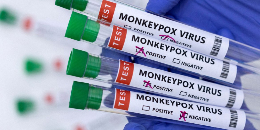 Região tem mais de 60 casos de Monkeypox