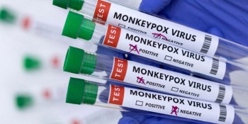 Região tem mais de 60 casos de Monkeypox