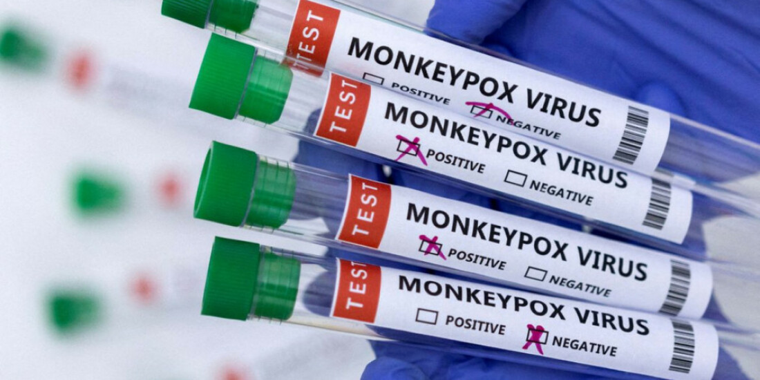 Região tem mais de 60 casos de Monkeypox