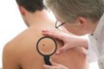 Hoje tem prevenção contra o câncer de pele na Policlínica da UMC