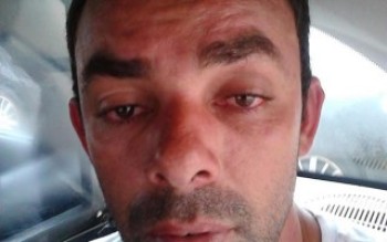 Mulher é queimada pelo ex no Rodeio