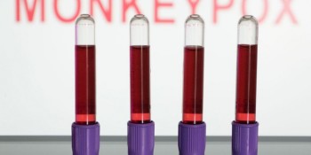 Sobe para 36 o número de casos de Monkeypox na região