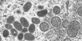 Mogi das Cruzes confirma o segundo caso de Monkeypox