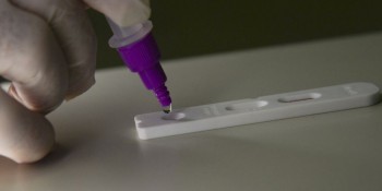 Covid-19: Brasil registra 266 óbitos e 77,1 mil casos em 24 horas