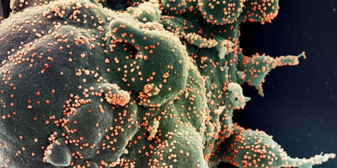 Fiocruz usa sequenciamento de DNA para pesquisar covid grave em jovens