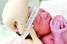 Ministério registra 270 casos de microcefalia