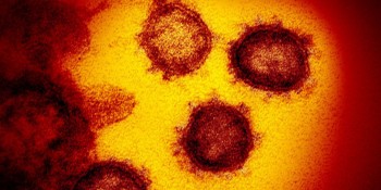 Estudo aponta sequelas neurológicas em pacientes leves de covid-19