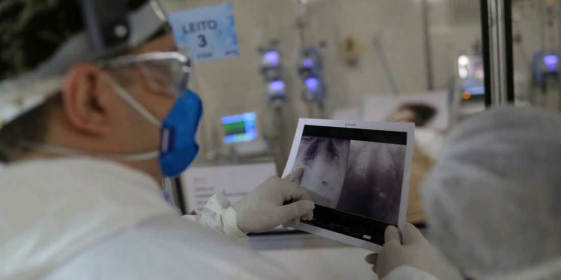 Barroso autoriza acesso da PF a provas da CPI da Covid