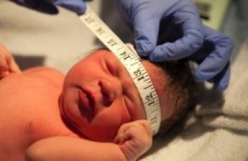 Brasil já registra 462 casos confirmados de microcefalia