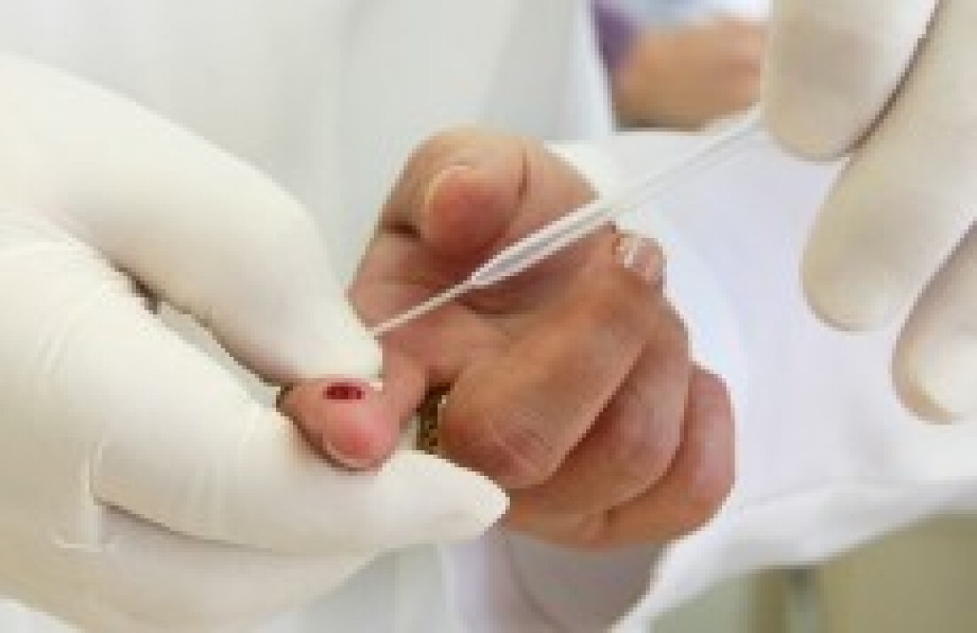 Alto Tietê registra 935 casos de sífilis