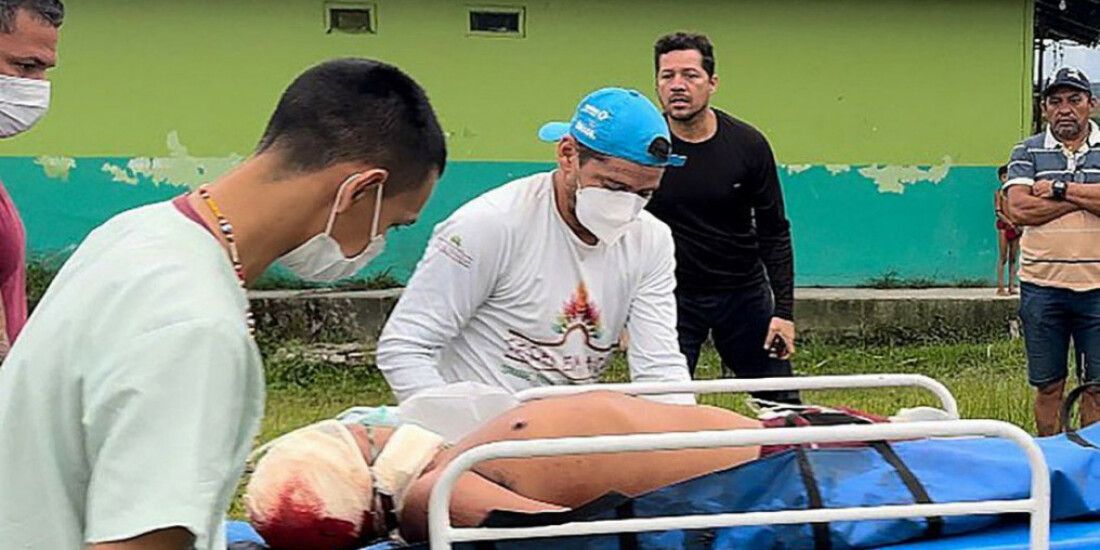 Um indígena é morto e dois são feridos em ataque na Terra Yanomami
