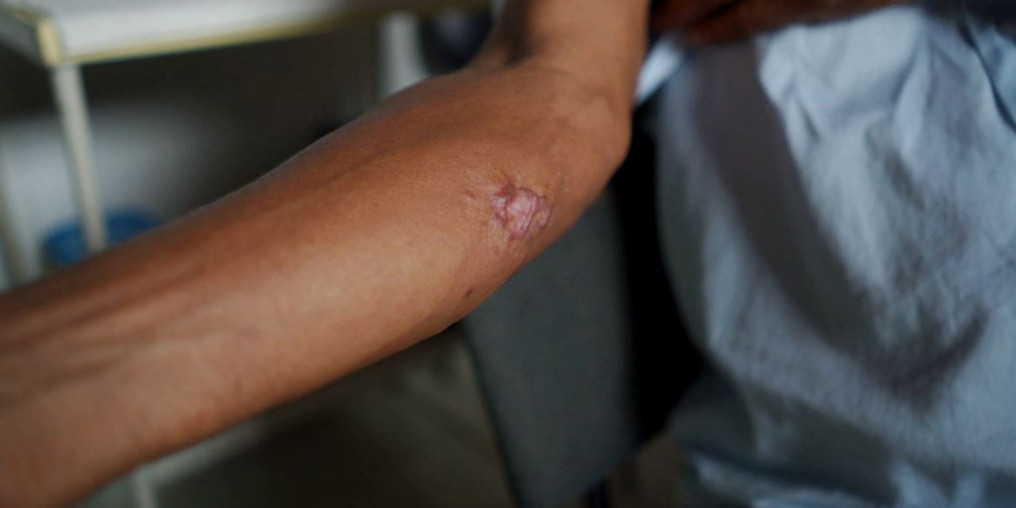 Doença de Chagas e leishmaniose são o tema do Caminhos da Reportagem