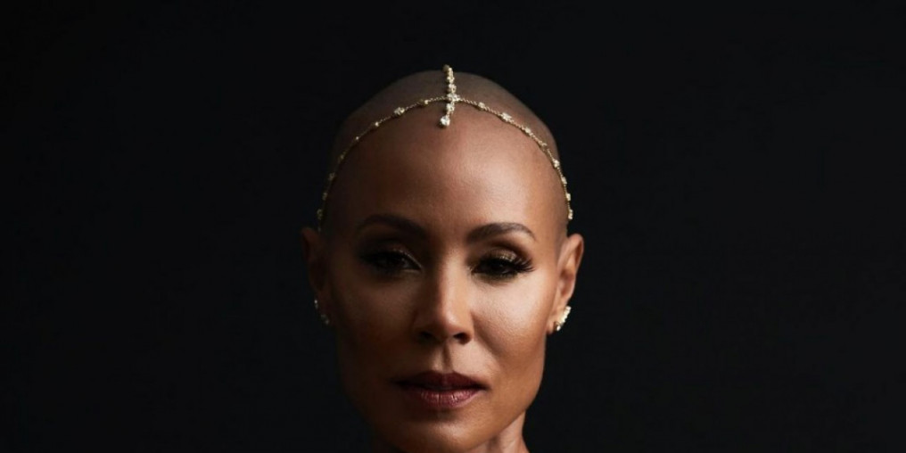 Especialista destaca formas da alopecia