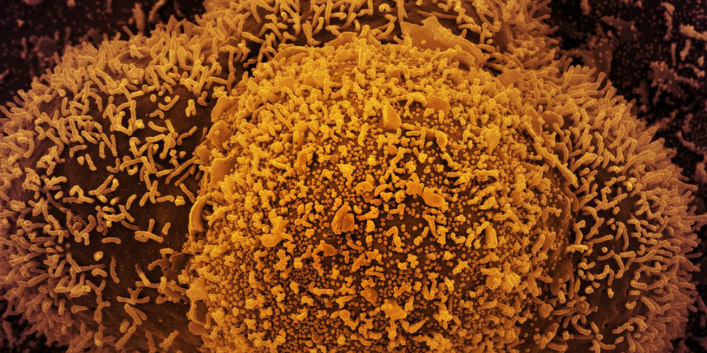 Brasil registra 657,1 mil mortes e 29,61 milhões de casos por covid-19