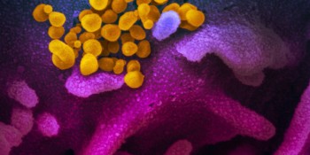 Brasil registra 657.205 mil mortes por covid-19