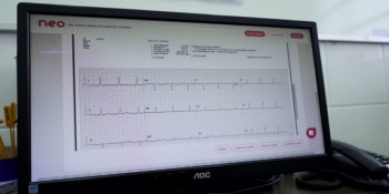 UPA do Rodeio recebe projeto para diagnóstico de infarto