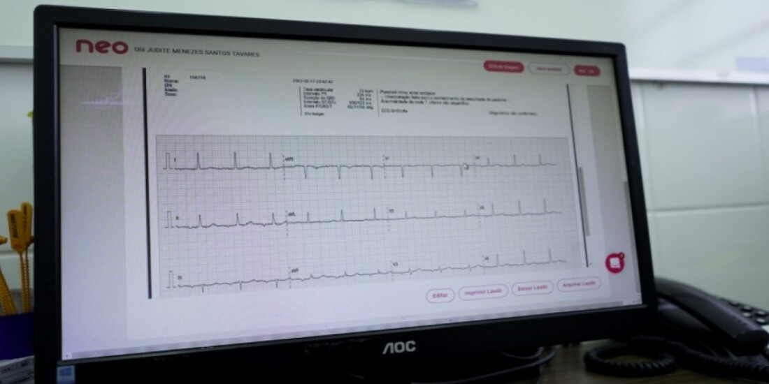 UPA do Rodeio recebe projeto para diagnóstico de infarto