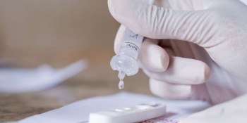 Taxa de positividade de testes de covid-19 cai para 6,8% no Rio