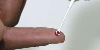Pesquisadores da Fiocruz analisam coinfecção por HIV e HTLV na Bahia