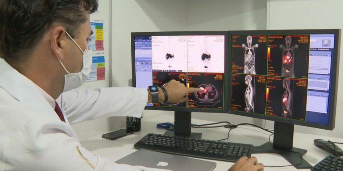 Metade dos pacientes do SUS com câncer se tratam fora de suas cidades