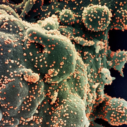 Brasil registra quase 4 mil casos de covid-19 em 24 horas