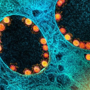 Primeira pessoa morre infectada pela variante Ômicron no Reino Unido