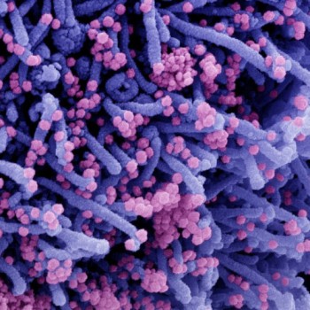 Delta é responsável por 99,7% dos casos de covid-19 em São Paulo