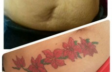 Tatuadora mogiana transforma cicatrizes de mulheres em arte