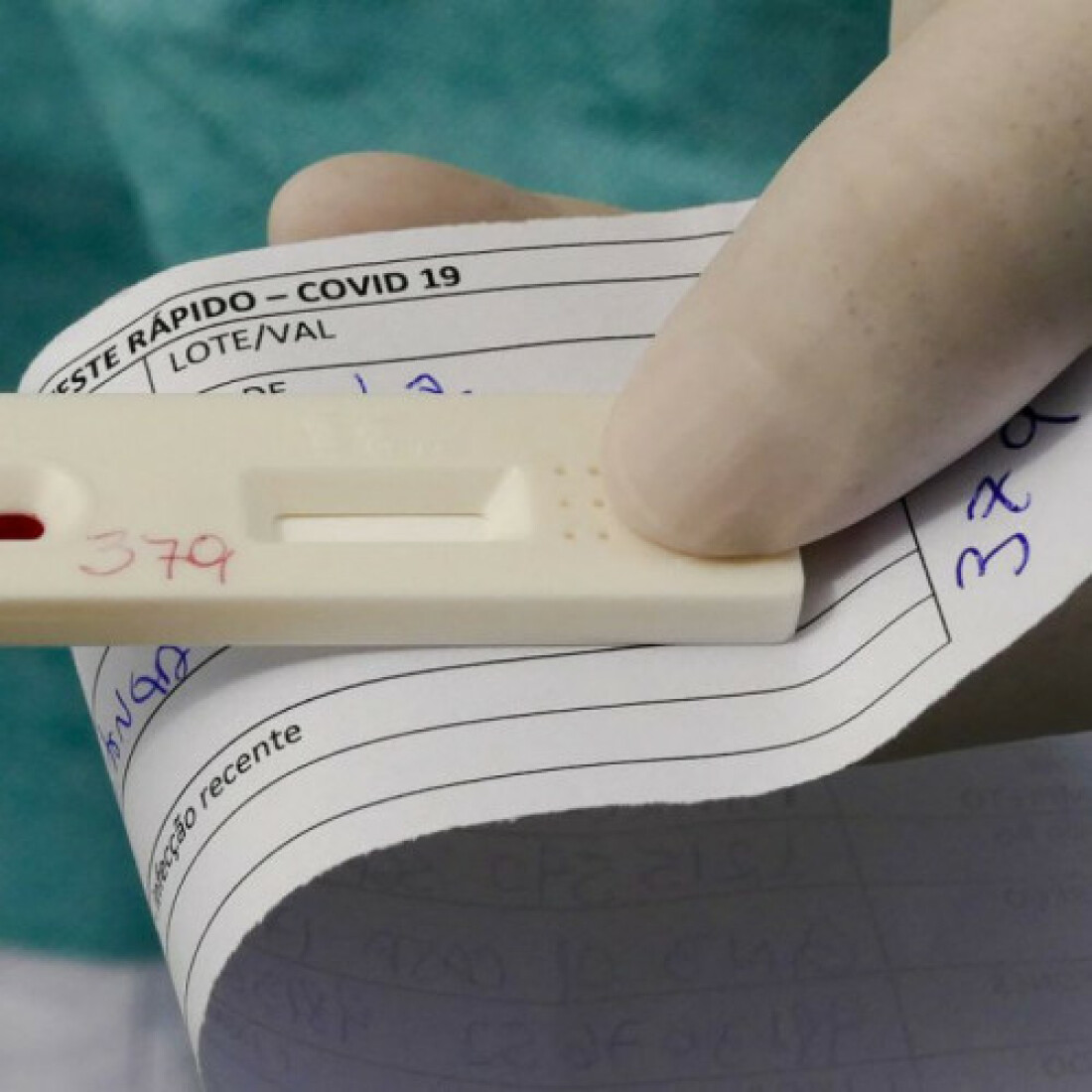 Anvisa aprova novo teste de diagnóstico para covid-19