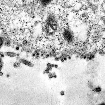 Incidência de SRAG parou de cair e pode voltar a crescer, diz Fiocruz