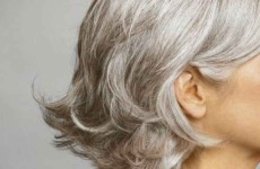 Por que alguns jovens já têm cabelo branco?